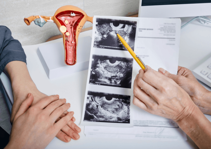 Blog de ginecologia em Varginha da Dra. Eveline Guedes 1 Paciente em consulta ginecológica para avaliar sintomas de cisto no ovário.